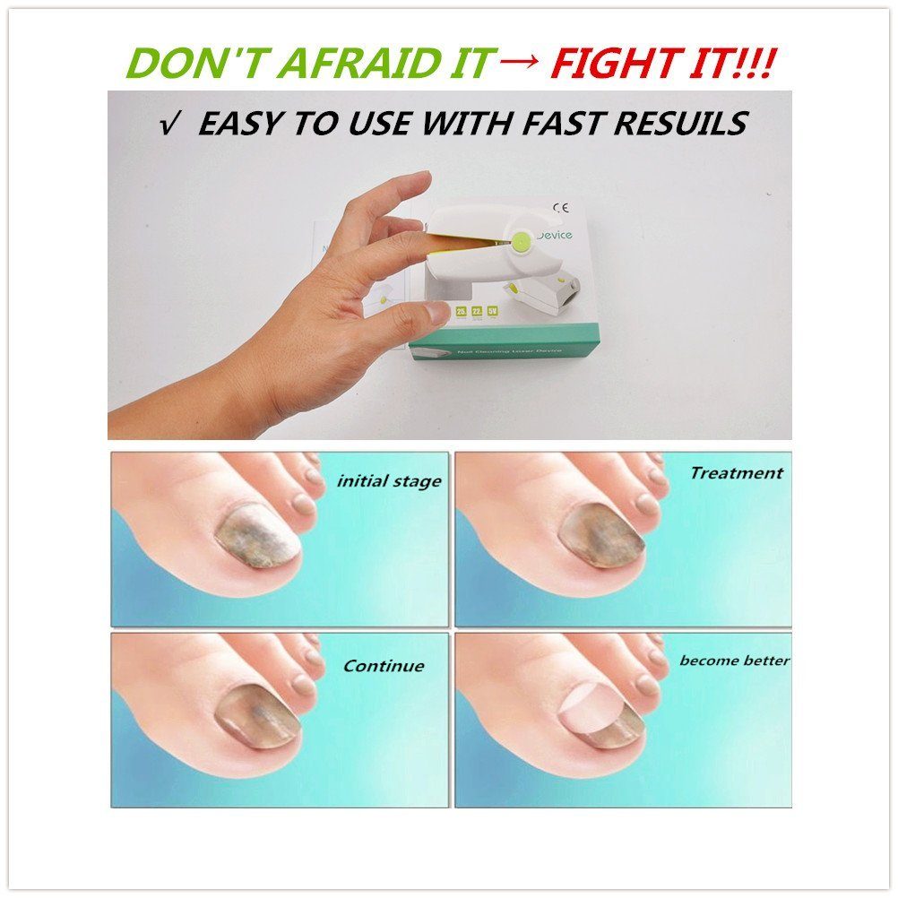 faladi nail cleaning laser device