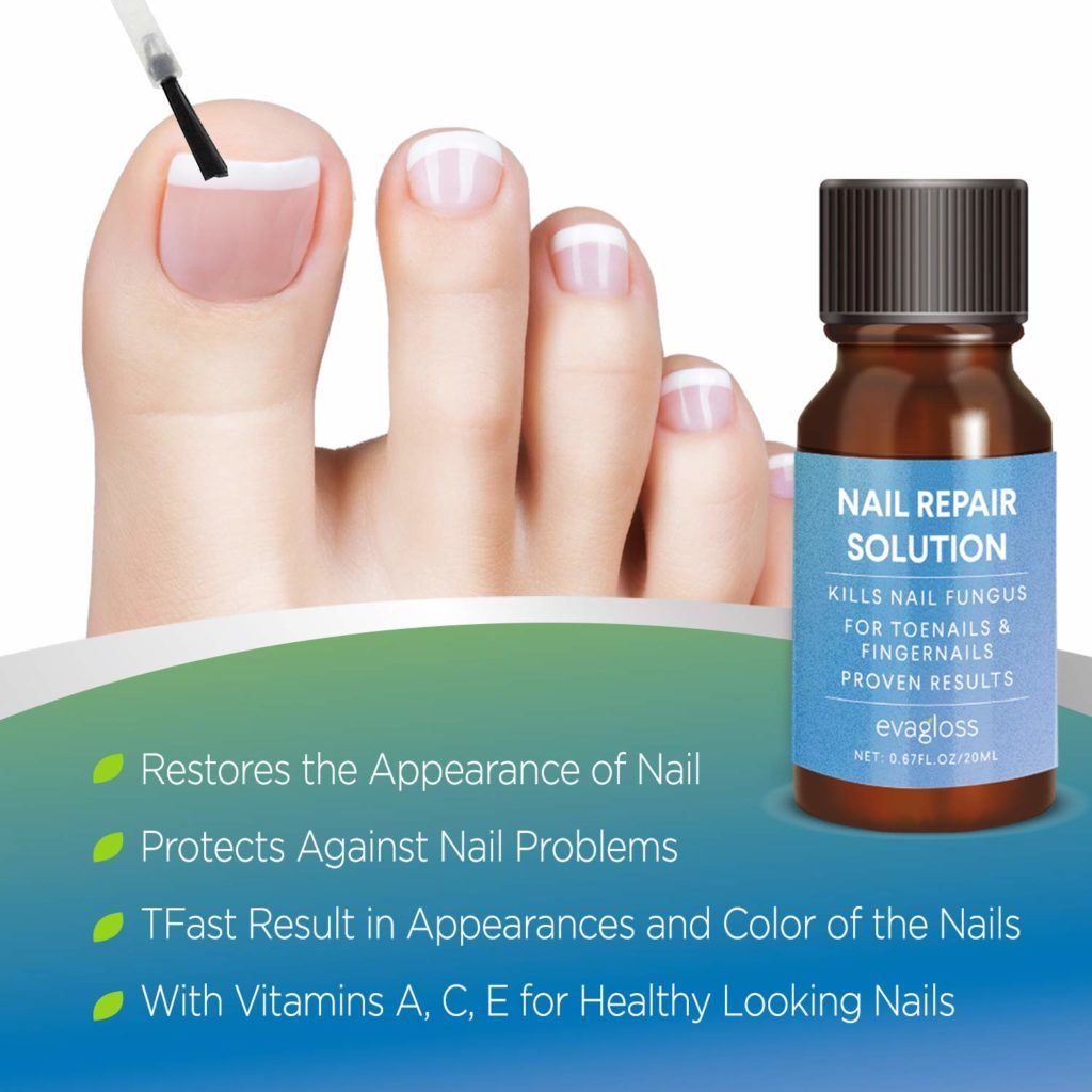 antifungal toenail solution